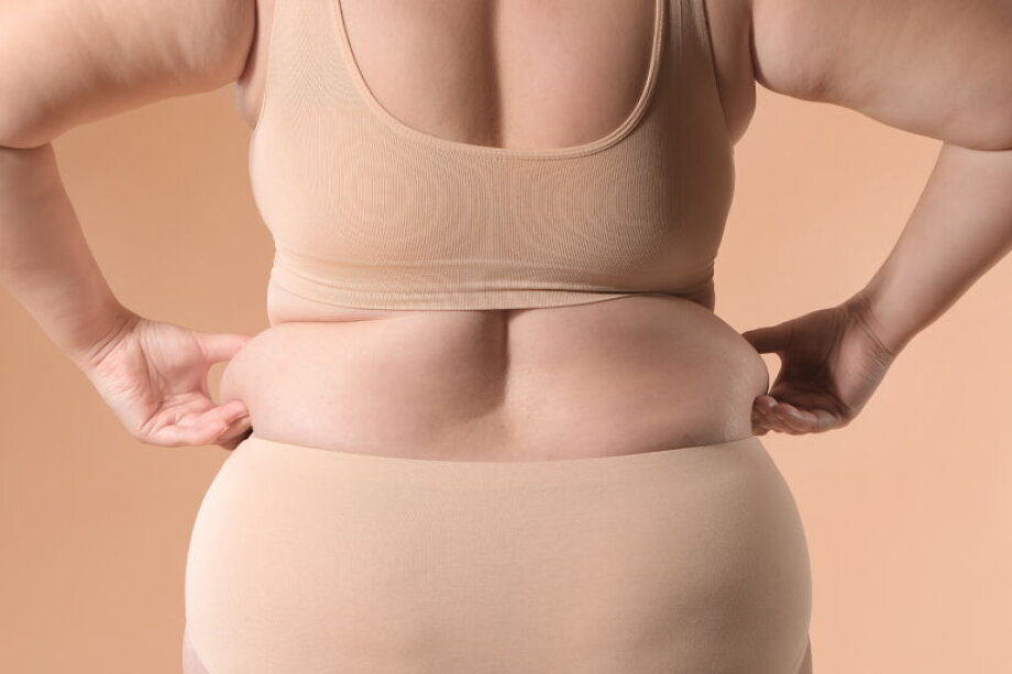 Obesity costs set to surge