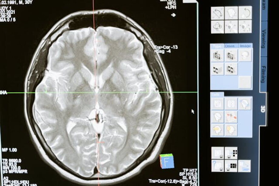 BrainScan increased database of tomography head scans for training AI