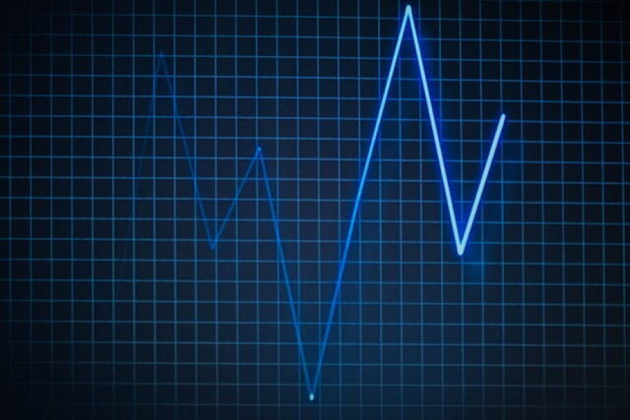 Romania falling into recession, but Polish investors believe in country