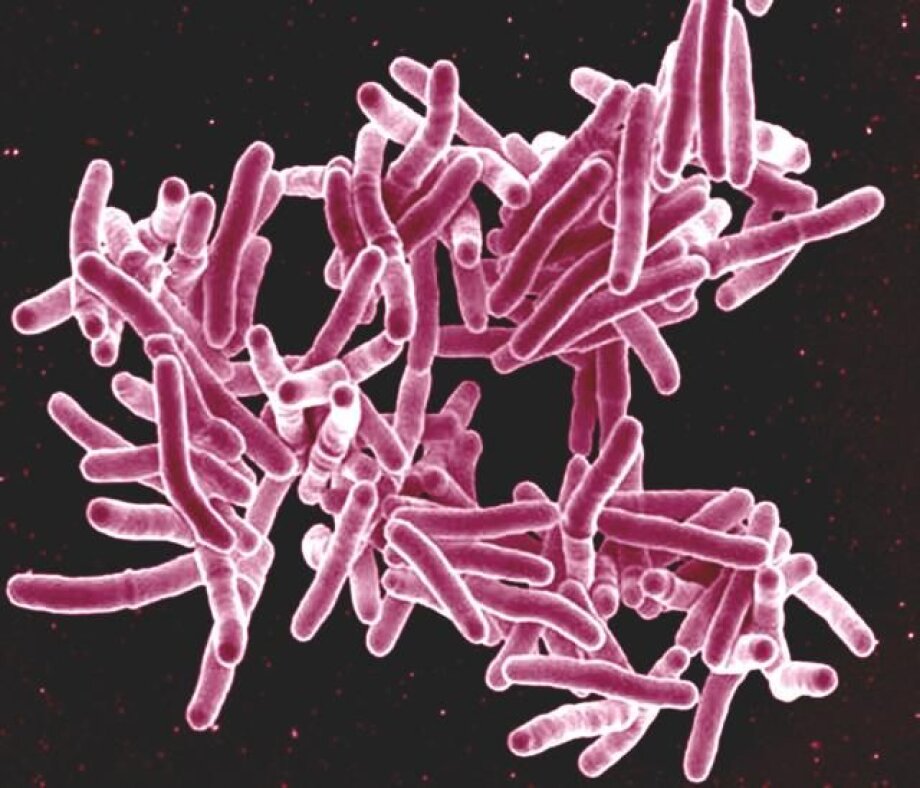 WHO: 30 new cases of TB in Europe every hour